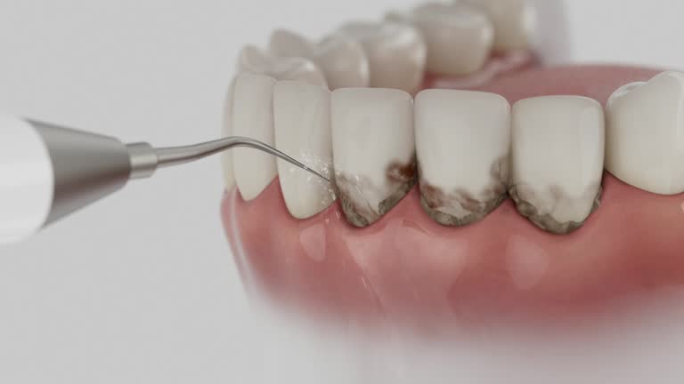 Trusted Wisdom Tooth Removal service in Terrytown, LA - Dentist Open Now